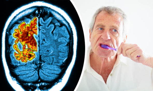 Как да излекуваме Пародонтит и да предотвратим болест на Алцхаймер?!